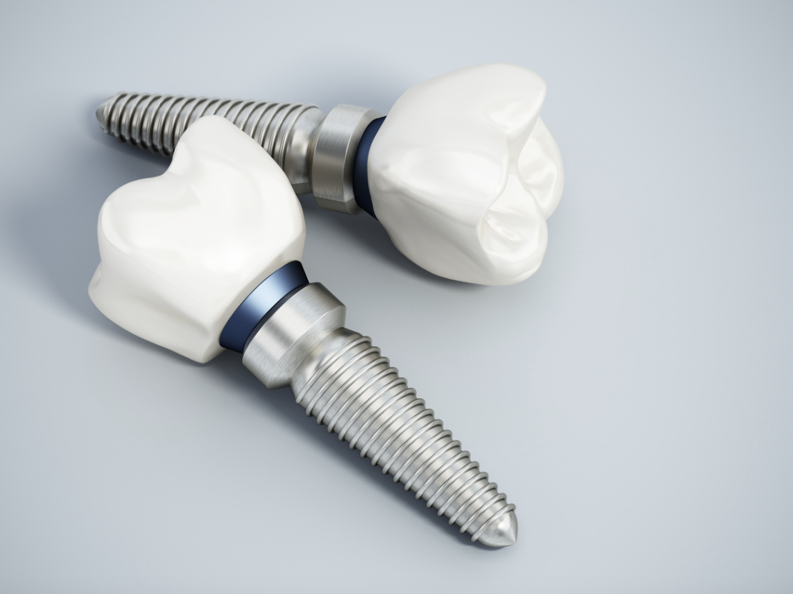 Subcategory: Implant treatment - Ziacom Medical